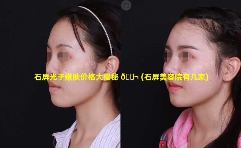 石屏光子嫩肤价格大揭秘 🐬 (石屏美容院有几家)